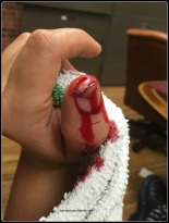 Thumb tip cut